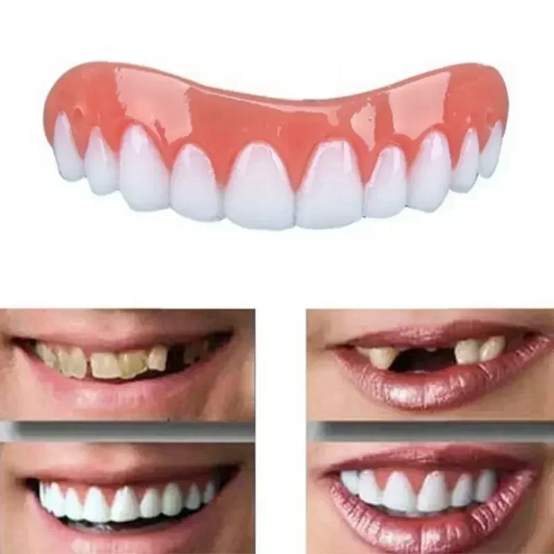Teeth Whitening Veneers - 新しいシリコン製義歯 上歯・下歯 ベニア 完璧な笑顔ベニア 義歯ペースト 偽歯矯正器具