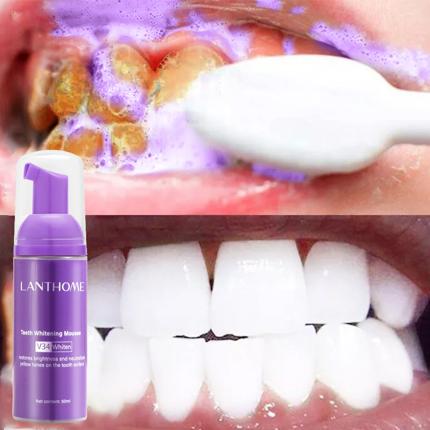 Teeth Whitening Xylitol - V34 ホワイトニングムース歯磨き粉 歯垢除去 ステイン除去 口腔衛生 ブリーチング