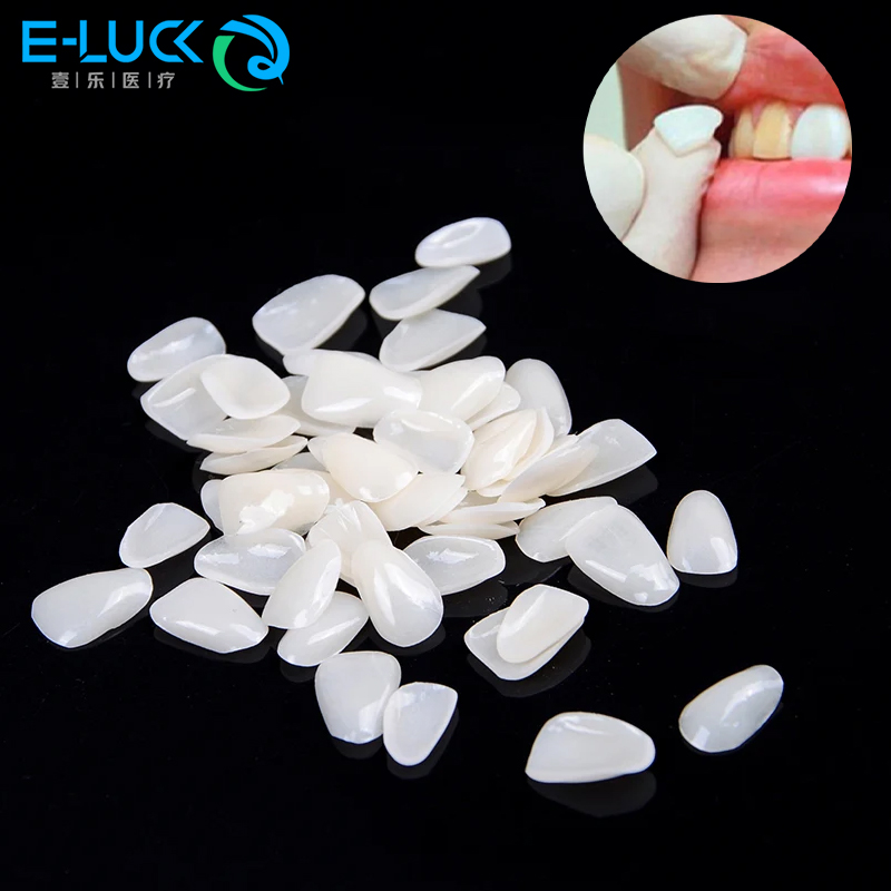 Teeth Whitening Veneers - 50 個歯科歯ベニア一時的なクラウン超薄型樹脂歯科歯保護口腔ケア