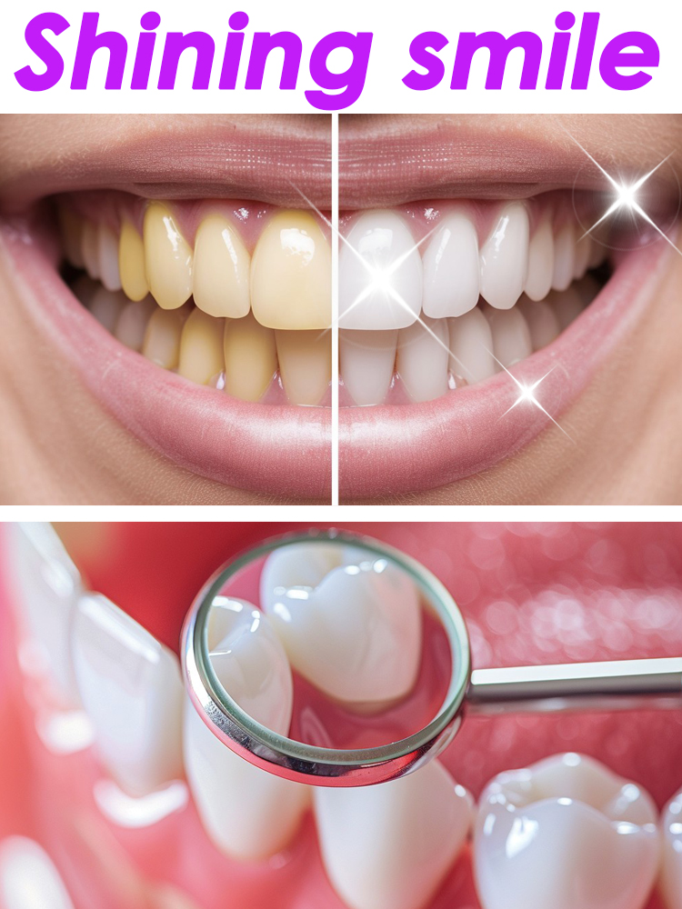 グローリースマイル ホワイトニング フルーティー歯磨き粉 デ - Teeth Whitening Xylitol のレビューと価格