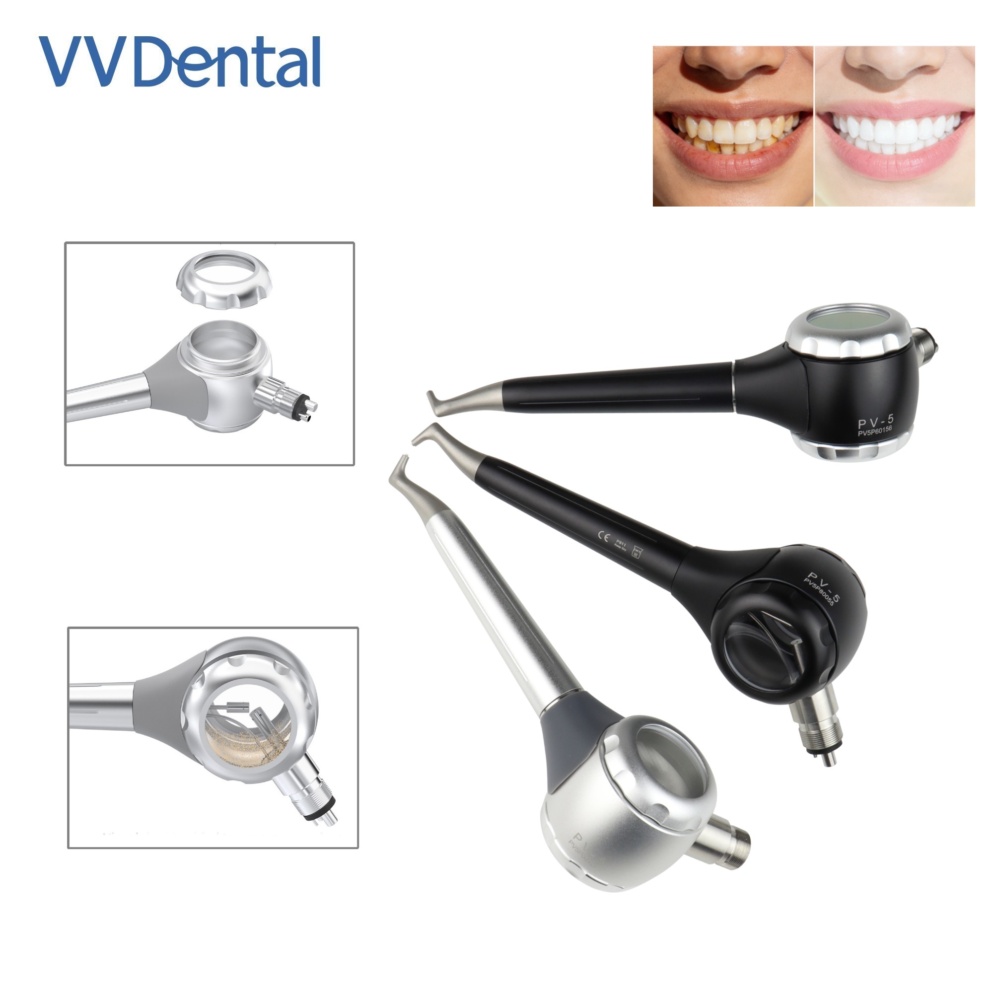 VV デンタル 2/4 穴歯ホワイトニングサンドブラストガン - Teeth Whitening Free のレビューと価格