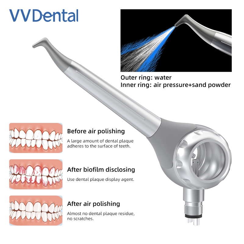 VV デンタル 2/4 穴歯ホワイトニングサンドブラストガン - Teeth Whitening Free のレビューと価格