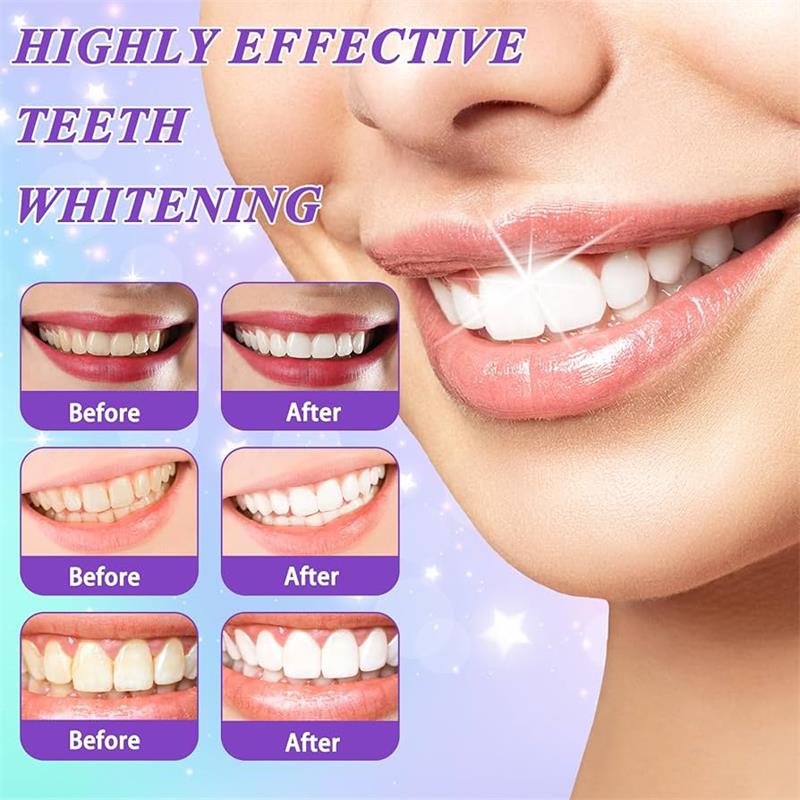 9D パープル歯磨き粉ムース 黄ばんだ歯の汚れ除去用集中ステ - Teeth Whitening Foam のレビューと価格