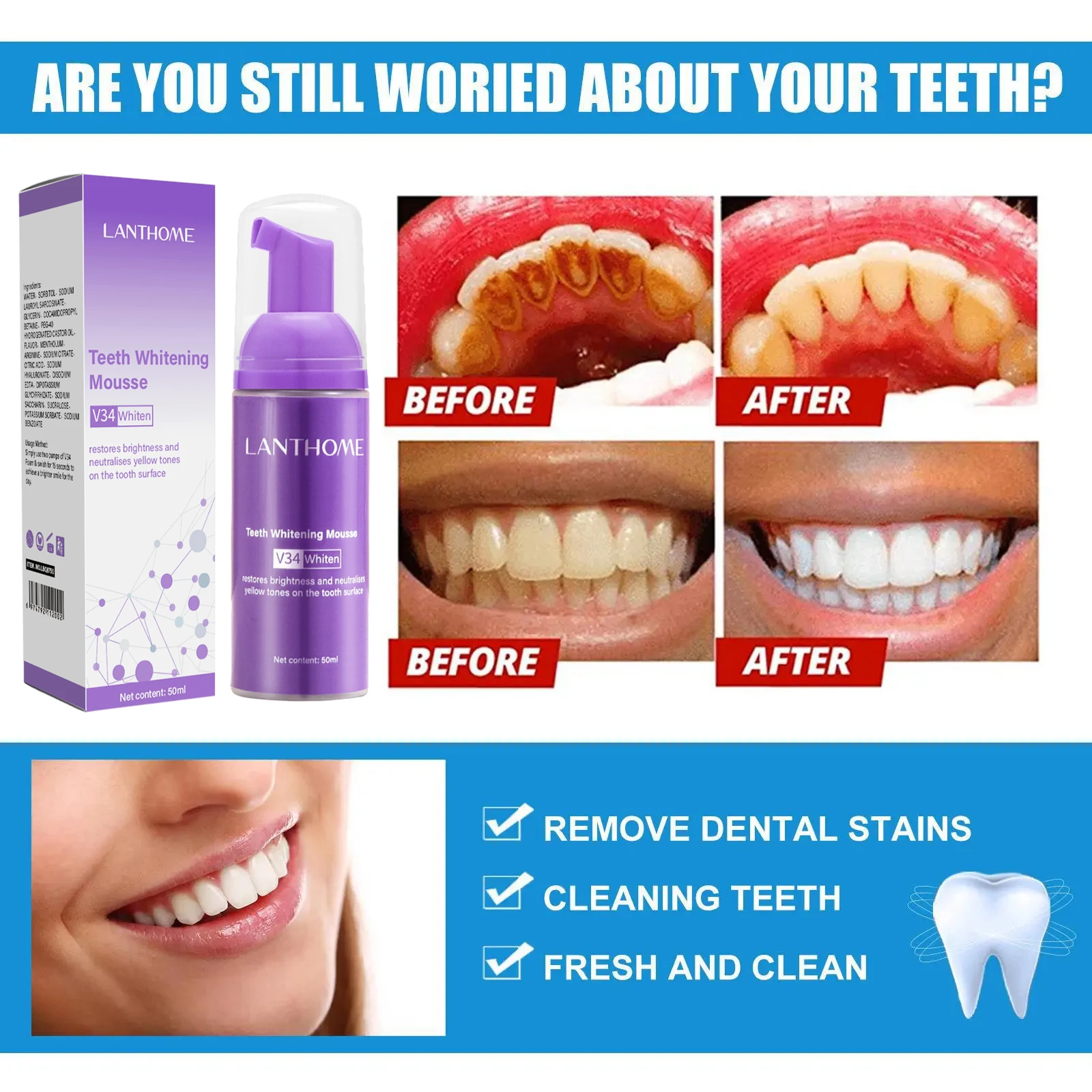 V34 ホワイトニングムース歯磨き粉 歯垢除去 ステイン除去 - Teeth Whitening Xylitol のレビューと価格