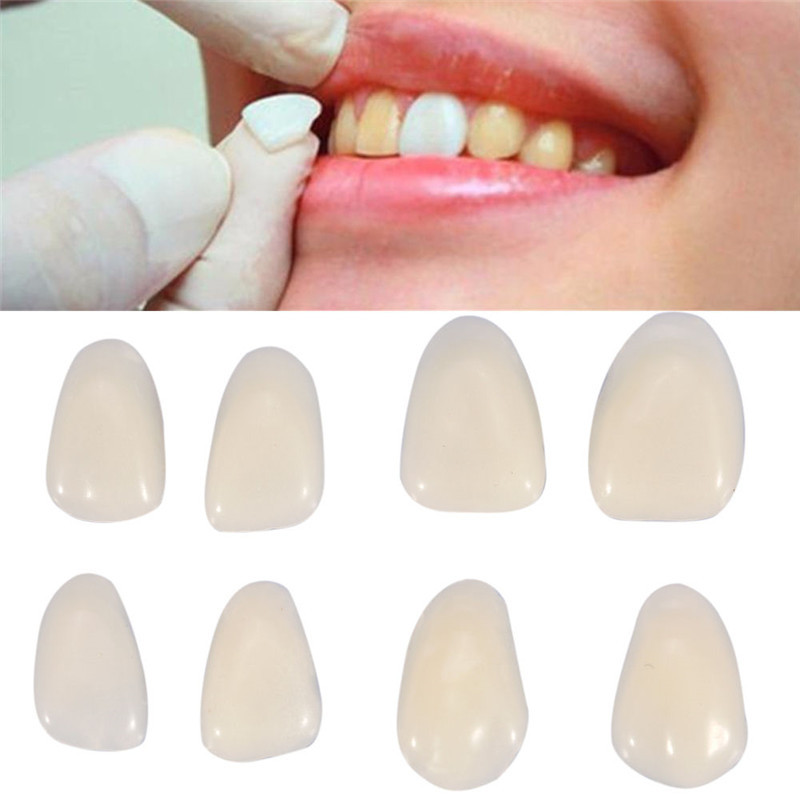 歯科入れ歯一時的なクラウン歯ベニア歯上部前歯ホワイトニング口 - Teeth Whitening Veneers のレビューと価格